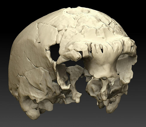 cranium2