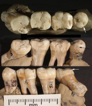 Analysis of Neanderthal teeth grooves uncovers evidence of prehistoric dentistry – Popular Archeology - Popular Archaeology