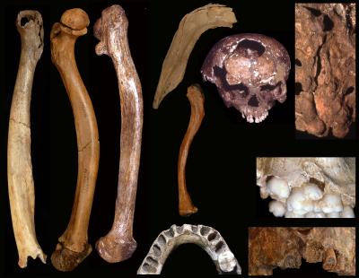 Skeletal abnormalities in Pleistocene people – Popular Archeology - Popular Archaeology