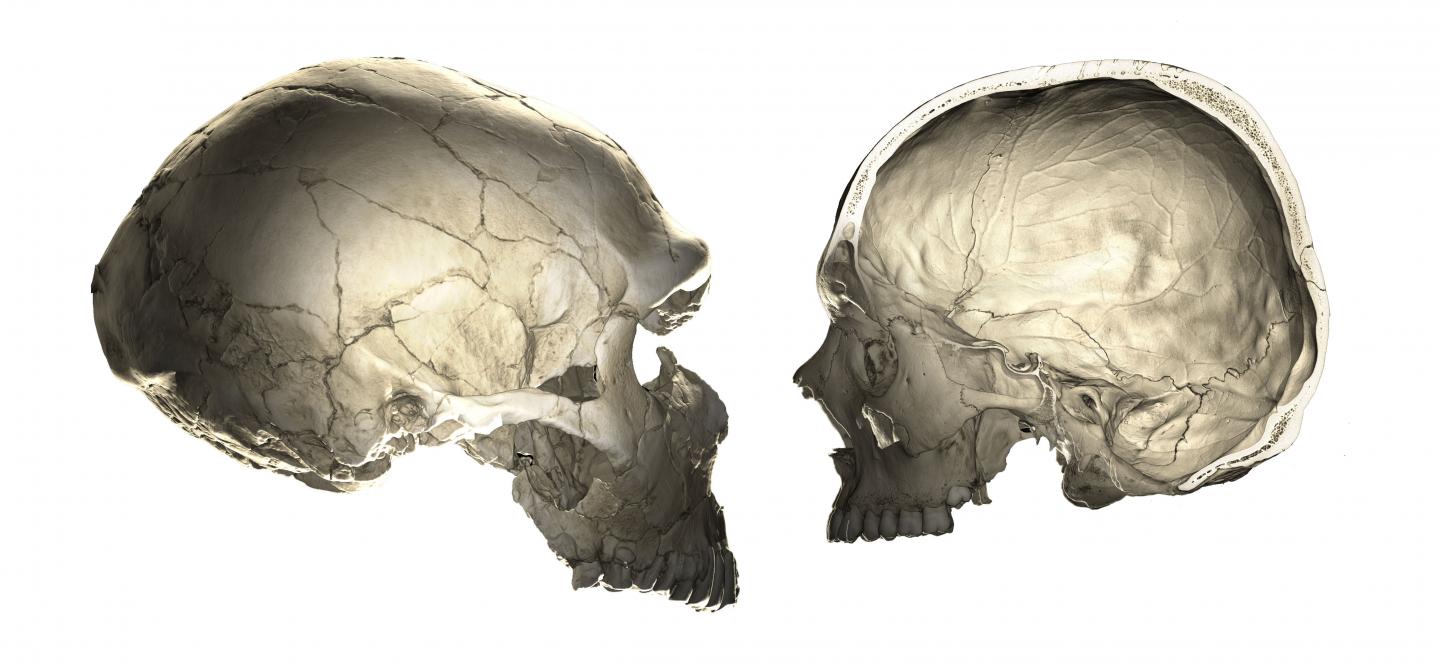 Neanderthal Genes Give Clues To Human Brain Evolution Popular Archeology   Neandertalbraincase1 